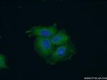 SH3GLB2 Antibody in Immunocytochemistry (ICC/IF)