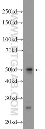SH3GLB2 Antibody in Western Blot (WB)