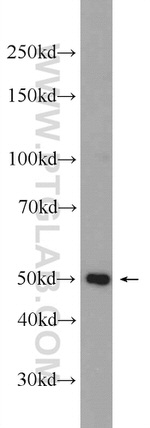 SH3GLB2 Antibody in Western Blot (WB)