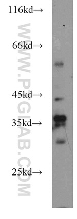 NECAP2 Antibody in Western Blot (WB)