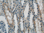 ACTO9 Antibody in Immunohistochemistry (Paraffin) (IHC (P))