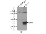 GSTP1 Antibody in Immunoprecipitation (IP)