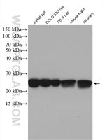 GSTP1 Antibody in Western Blot (WB)