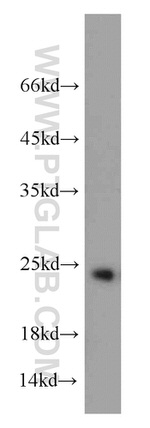GSTP1 Antibody in Western Blot (WB)