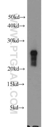 GSTP1 Antibody in Western Blot (WB)