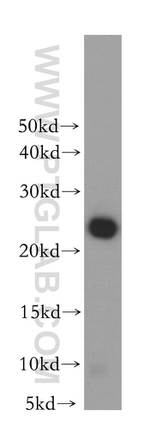 GSTP1 Antibody in Western Blot (WB)