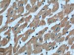 RAB11A/B Antibody in Immunohistochemistry (Paraffin) (IHC (P))