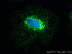 RAB11A/B Antibody in Immunocytochemistry (ICC/IF)