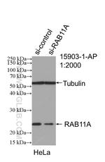 RAB11A/B Antibody in Western Blot (WB)