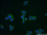 IDH3A Antibody in Immunocytochemistry (ICC/IF)