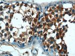 ALDH1A1 Antibody in Immunohistochemistry (Paraffin) (IHC (P))