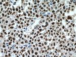 UBE1 Antibody in Immunohistochemistry (Paraffin) (IHC (P))