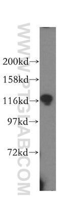 UBE1 Antibody in Western Blot (WB)