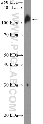 UBE1 Antibody in Western Blot (WB)