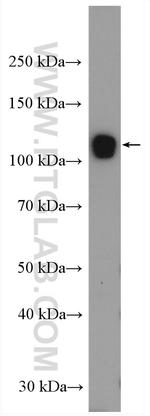 UBE1 Antibody in Western Blot (WB)