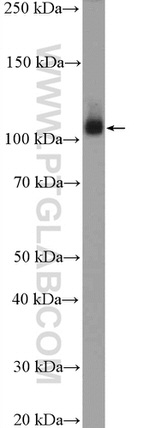 UBE1 Antibody in Western Blot (WB)