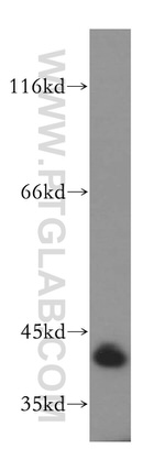MRPL38 Antibody in Western Blot (WB)