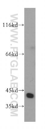 MRPL38 Antibody in Western Blot (WB)