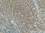 CTP synthase Antibody in Immunohistochemistry (Paraffin) (IHC (P))