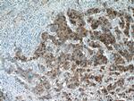 AMACR/p504S Antibody in Immunohistochemistry (Paraffin) (IHC (P))