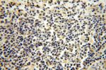 POLR1C Antibody in Immunohistochemistry (Paraffin) (IHC (P))