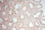 POLR1C Antibody in Immunohistochemistry (Paraffin) (IHC (P))