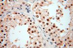 POLR1C Antibody in Immunohistochemistry (Paraffin) (IHC (P))