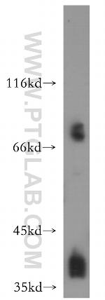 POLR1C Antibody in Western Blot (WB)