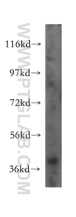 POLR1C Antibody in Western Blot (WB)