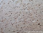 RHEB Antibody in Immunohistochemistry (Paraffin) (IHC (P))