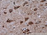 RHEB Antibody in Immunohistochemistry (Paraffin) (IHC (P))