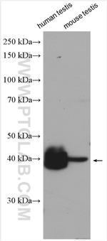 ART3 Antibody in Western Blot (WB)