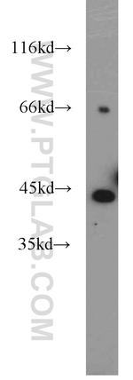 ART3 Antibody in Western Blot (WB)