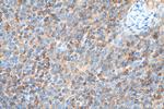 ValRS Antibody in Immunohistochemistry (Paraffin) (IHC (P))