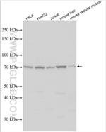 ABCD4 Antibody in Western Blot (WB)