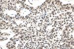 EXOSC4 Antibody in Immunohistochemistry (Paraffin) (IHC (P))