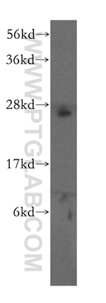 EXOSC4 Antibody in Western Blot (WB)