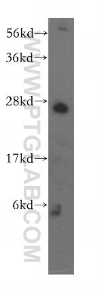 EXOSC4 Antibody in Western Blot (WB)