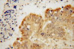 CNOT10 Antibody in Immunohistochemistry (Paraffin) (IHC (P))