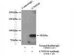 CNOT10 Antibody in Immunoprecipitation (IP)