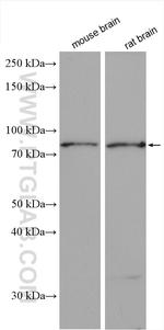 CNOT10 Antibody in Western Blot (WB)