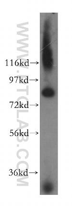 CNOT10 Antibody in Western Blot (WB)