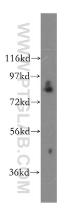 CNOT10 Antibody in Western Blot (WB)