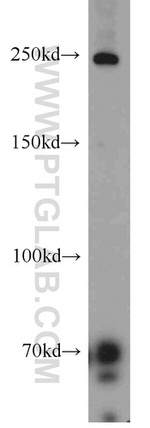 Piezo1 Antibody in Western Blot (WB)