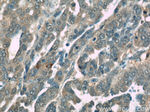 TIPE2 Antibody in Immunohistochemistry (Paraffin) (IHC (P))