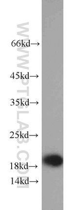 TIPE2 Antibody in Western Blot (WB)