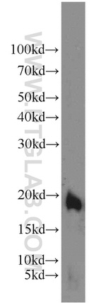 TIPE2 Antibody in Western Blot (WB)