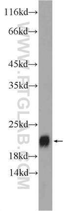 TIPE2 Antibody in Western Blot (WB)