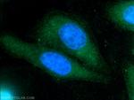 TIPE2 Antibody in Immunocytochemistry (ICC/IF)