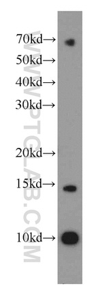TMEM50B Antibody in Western Blot (WB)